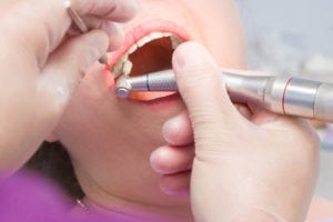 Fewer Dental Visits By Diabetics Concerning
