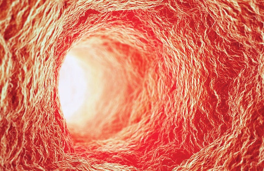 New Catheter Lets Doctors See Inside Arteries