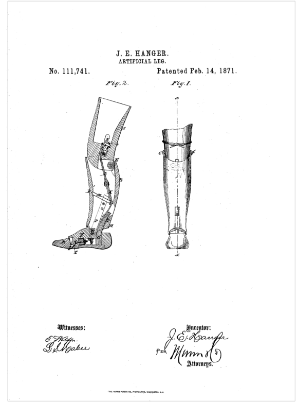 The Hanger Prosthetic Leg Turns 149 Years Old - Amplitude