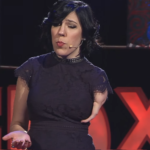 TED Talk amputee
