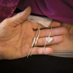 Spinal Stimulators Repurposed to Restore Touch in Lost Limbs
