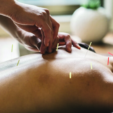 Acupuncture Before Surgery Reduces Pain and Opioid Use