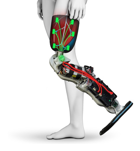 Advanced Bionic Leg 3835