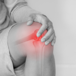 Amputees and Arthritis: Study Yields New Insights