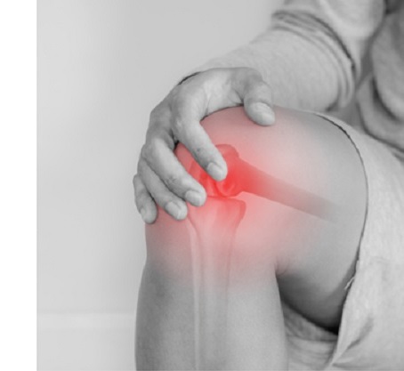 Amputees and Arthritis: Study Yields New Insights