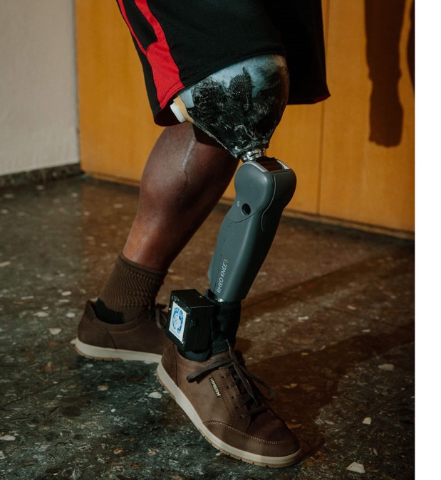 Breakthrough Bionic Leg Clears FDA Hurdle