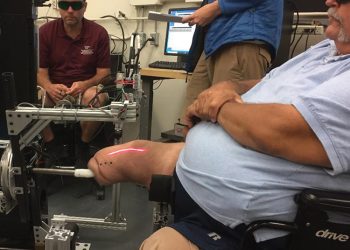 Smart Sockets for Amputees are on the Horizon