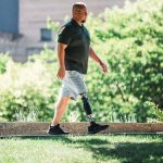 Össur's Latest Powered Prosthesis Is a Knee to Know