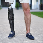The Most Affordable 3D-printed Prosthesis Covers for Amputees