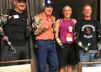 Bilateral Arm Amputees Thrive at Skills for Life