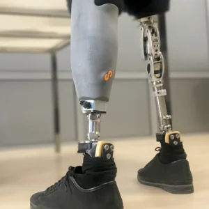 Medicare Coverage for 3D-Printed Prostheses Is Finally Here