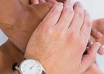 Amputee Coalition Joins Amputation Prevention Alliance