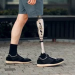 Does OI Really Help Amputees Regain Balance?
