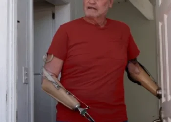 The Amputee Movie Character John Lawson Has Always Wanted to Play