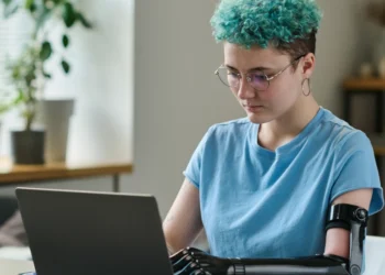 How to Be an Amputee With a Job