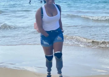 This Amputee Is Surviving, and Thriving, After Sepsis