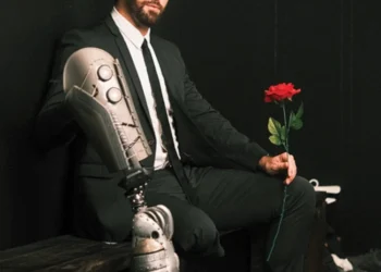 Cam Ayala: Losing a Limb Helped Me Find My Way to Love