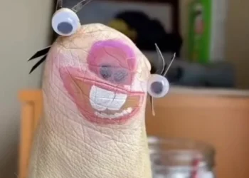 The Secret Lives of Amputee Limbs