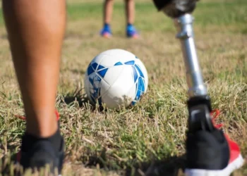 Summer Camps for Amputee Kids 2024