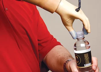 When Will Mind-Controlled Prosthetics Reach Consumers?