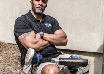 A Barber Cuts Loose After Limb Loss