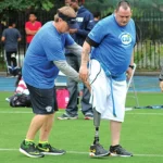 Tips for Getting the Best Results From Your Prosthesis