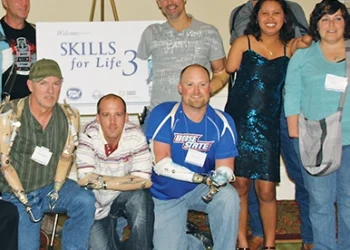 Workshop for Bilateral Upper-limb Amputees Scheduled for October