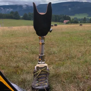 Seeds of Hope for Rural Amputees