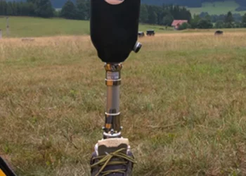 Seeds of Hope for Rural Amputees