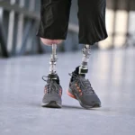 New Numbers Clarify Osseointegration Outcomes