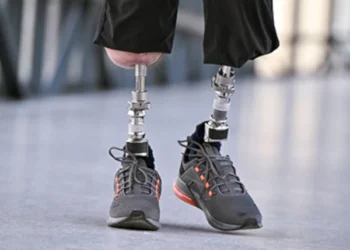 New Numbers Clarify Osseointegration Outcomes