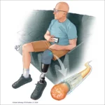Taking Power Over Pain with Altius 