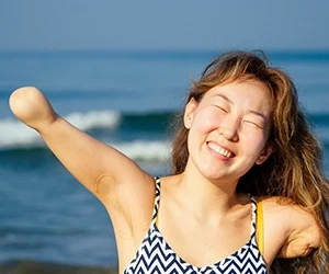 An Amputee’s Guide to Summer Fun