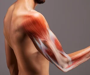 Can Muscle Training Improve Prosthetic Control?
