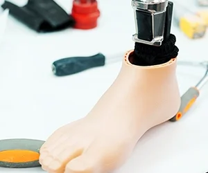 When the “Best” Prosthetic Foot Isn’t the Favorite
